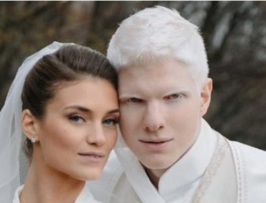 A legjóképűbb albínó modell megmutatta a kisfiát, azonnal felrobbant a net!