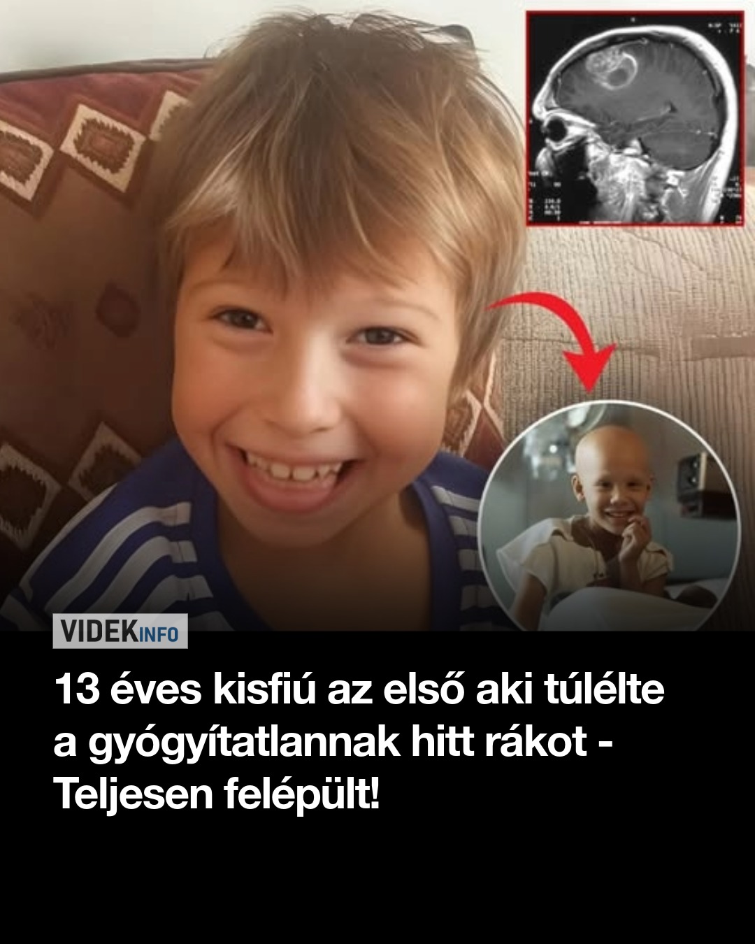 13 éves kisfiú az első aki túlélte a gyógyítatlannak hitt rákot – Teljesen felépült!