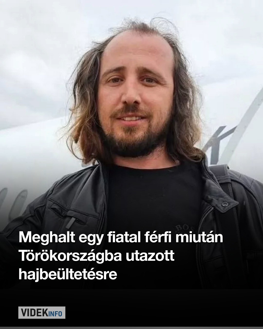 Meghalt egy fiatal férfi miután Törökországba utazott hajbeültetésre