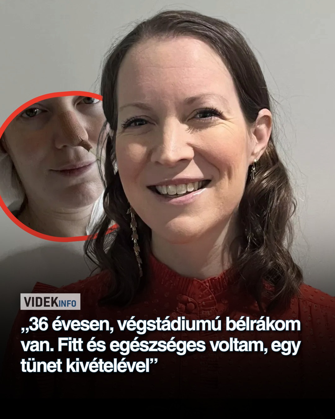 „36 évesen, végstádiumú bélrákom van. Fitt és egészséges voltam, egy tünet kivételével”