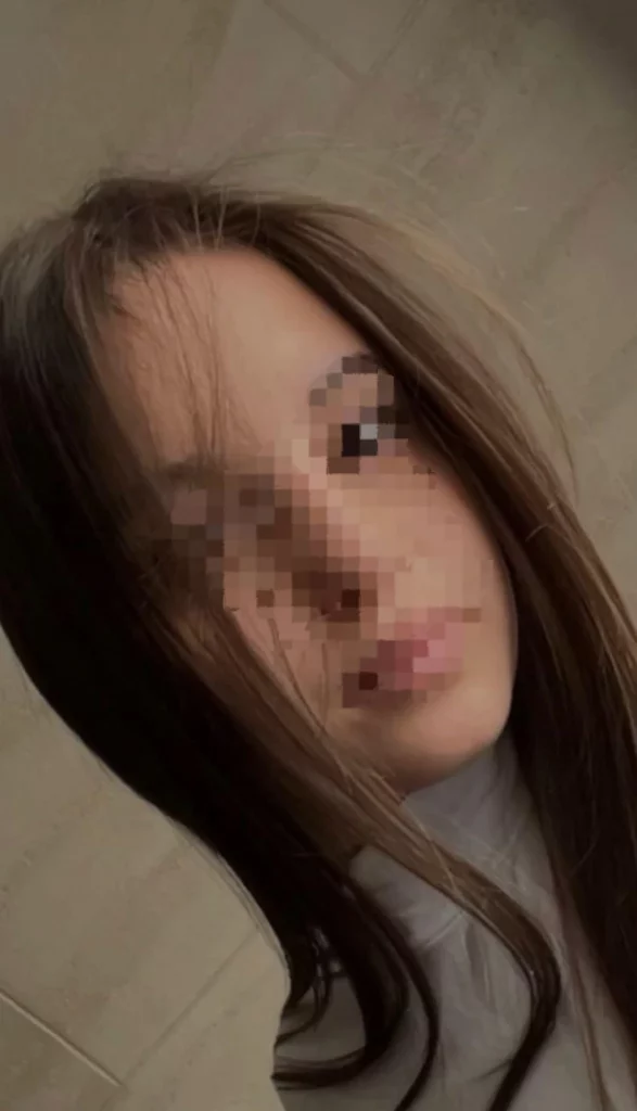 16 éve elektromos rolleres lányt gázolt el egy autó Újvásárban, nem tudták megmenteni az életét