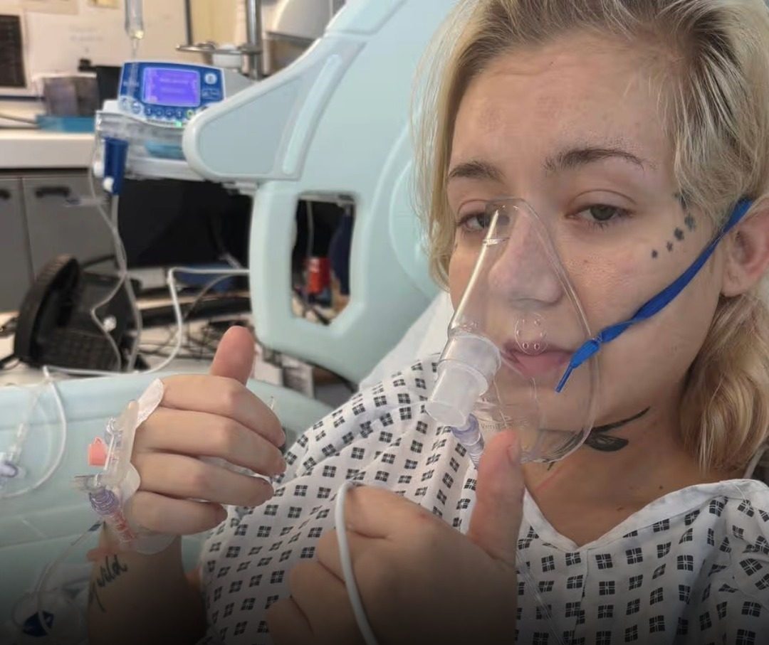 Tüdőrákot diagnosztizáltak a fiatal lánynál aki 15 éves kora óta vape-et szívott